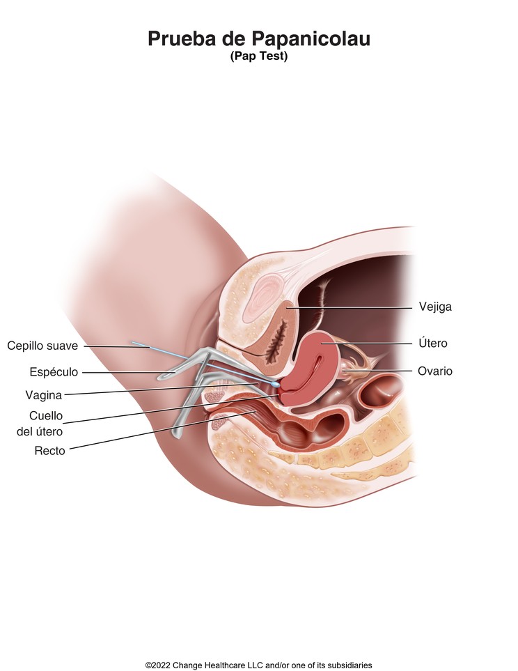Pap Test: Illustration