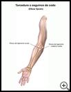 Thumbnail image of: Elbow Sprain: Illustration