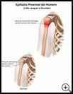 Thumbnail image of: Little Leaguer's Shoulder (Proximal Humeral Epiphysitis): Illustration