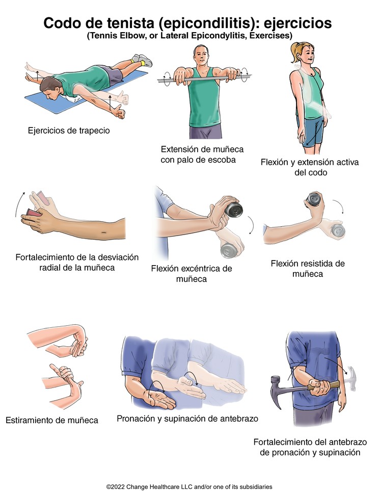 Tennis Elbow Exercises: Illustration
