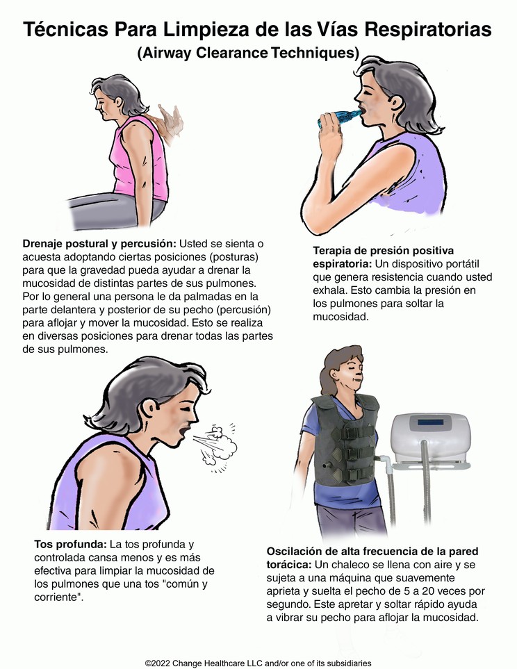 Airway Clearance Techniques: Illustration