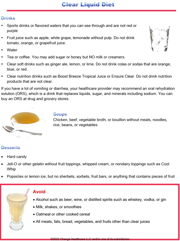 Clear Liquid Diet: Checklist