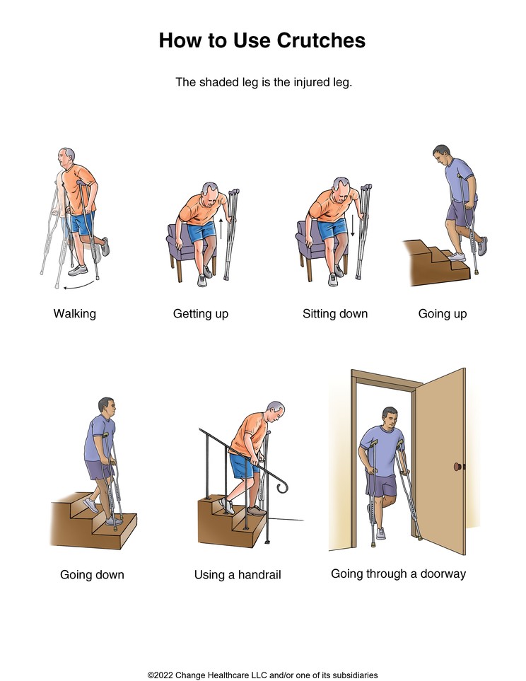 Crutches, How to Use: Illustration
