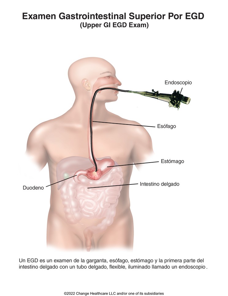 Upper GI EGD Exam: Illustration