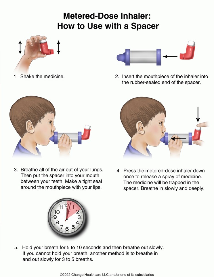 Metered-Dose Inhaler, How to Use with a Spacer: Illustration