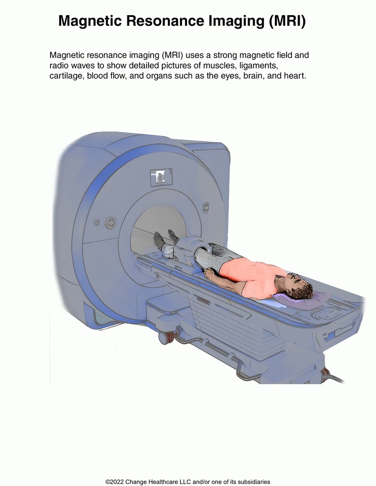 Magnetic Resonance Imaging (MRI): Illustration