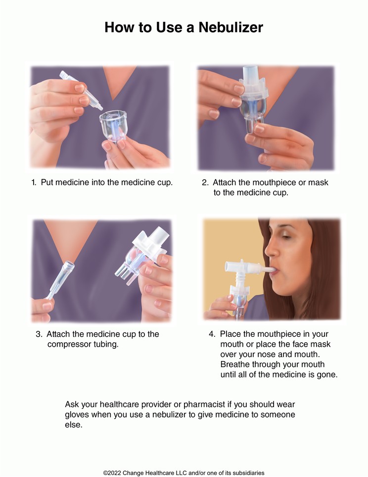 Nebulizer, How to Use: Illustration