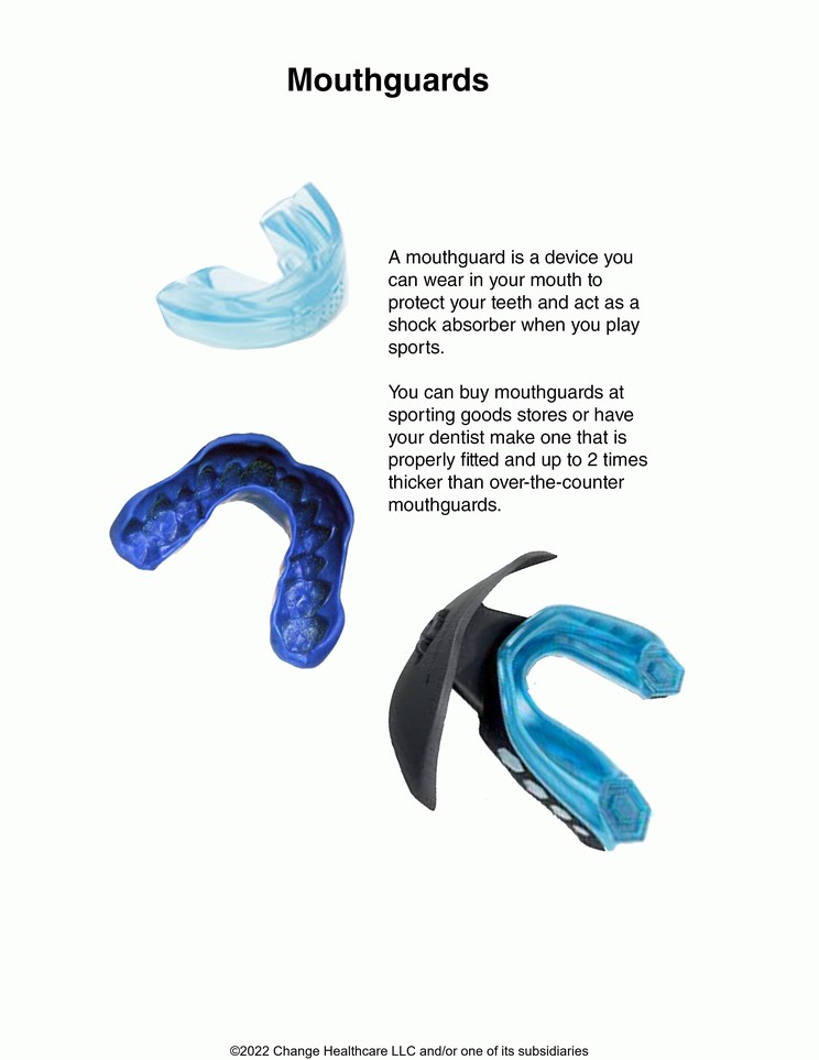 Mouthguards: Illustration