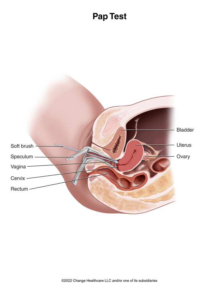 Pap Test: Illustration