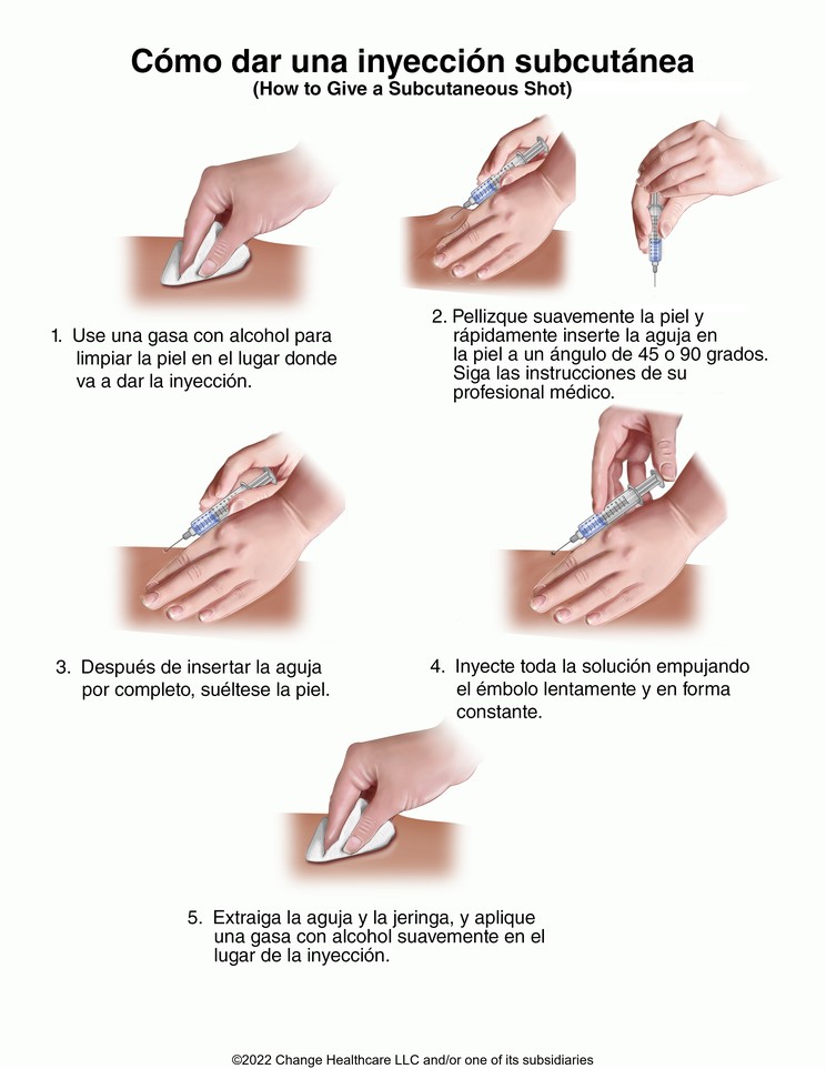 Subcutaneous Shot, How to Give: Illustration