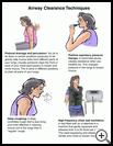 Thumbnail image of: Airway Clearance Techniques: Illustration