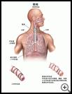 Thumbnail image of: Asthma: Illustration