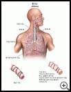 Thumbnail image of: Asthma: Illustration