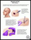 Thumbnail image of: Skin Biopsy: Illustration