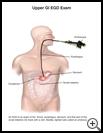 Thumbnail image of: Upper GI EGD Exam: Illustration