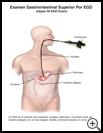 Thumbnail image of: Upper GI EGD Exam: Illustration