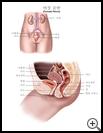 Thumbnail image of: Female Pelvis: Illustration