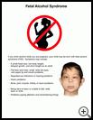 Thumbnail image of: Fetal Alcohol Syndrome in Children: Illustration