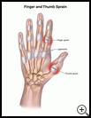 Thumbnail image of: Finger and Thumb Sprain: Illustration