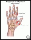 Thumbnail image of: Finger and Thumb Sprain: Illustration