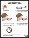 Thumbnail image of: Metered-Dose Inhaler, How to Use with a Spacer: Illustration