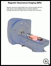 Thumbnail image of: Magnetic Resonance Imaging (MRI): Illustration