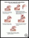 Thumbnail image of: Subcutaneous Shot, How to Give: Illustration