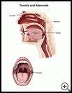 Thumbnail image of: Tonsils and Adenoids: Illustration