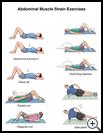 Thumbnail image of: Abdominal Muscle Strain Exercises: Illustration