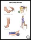 Thumbnail image of: Toe Fracture Exercises: Illustration