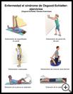 Thumbnail image of: Osgood-Schlatter Disease Exercises: Illustration, page 1