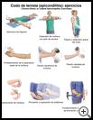 Thumbnail image of: Tennis Elbow Exercises: Illustration