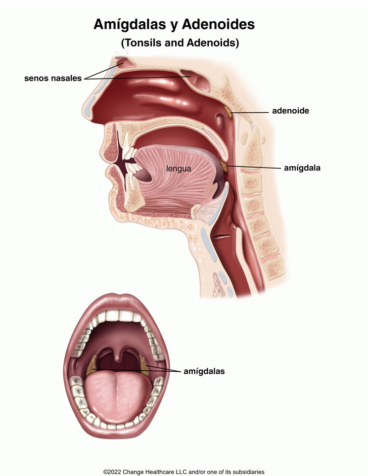 Tonsils and Adenoids: Illustration