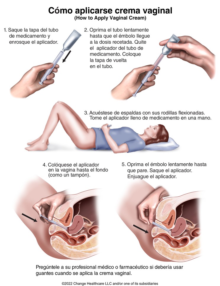 Vaginal Cream, How to Use: Illustration