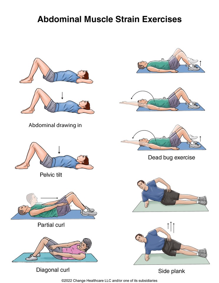 Abdominal Muscle Strain Exercises: Illustration