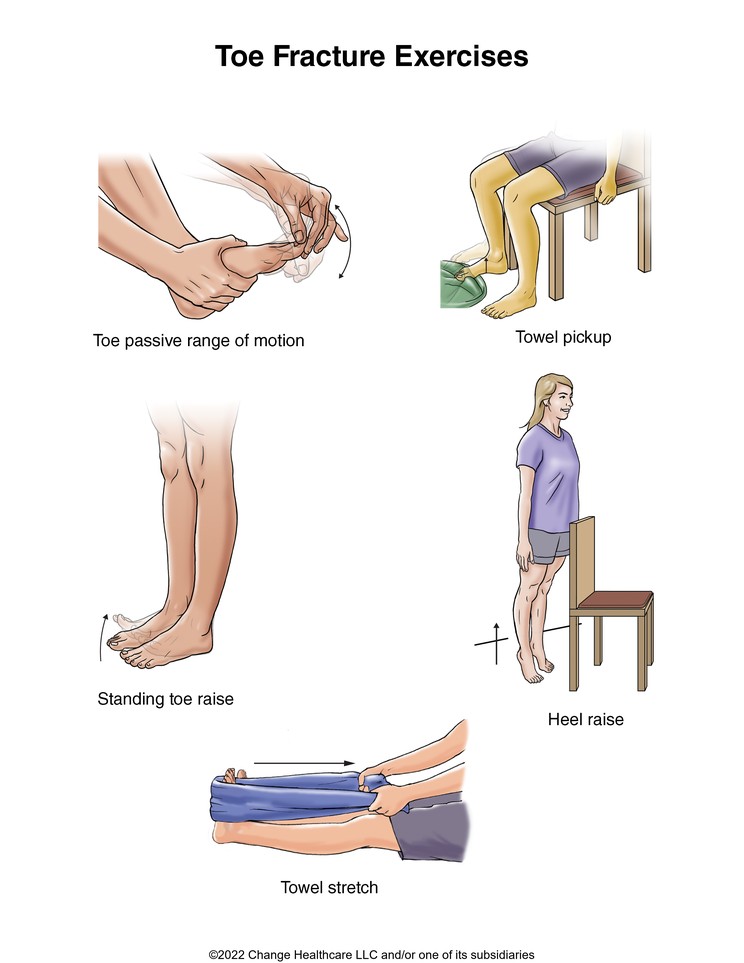 Toe Fracture Exercises: Illustration