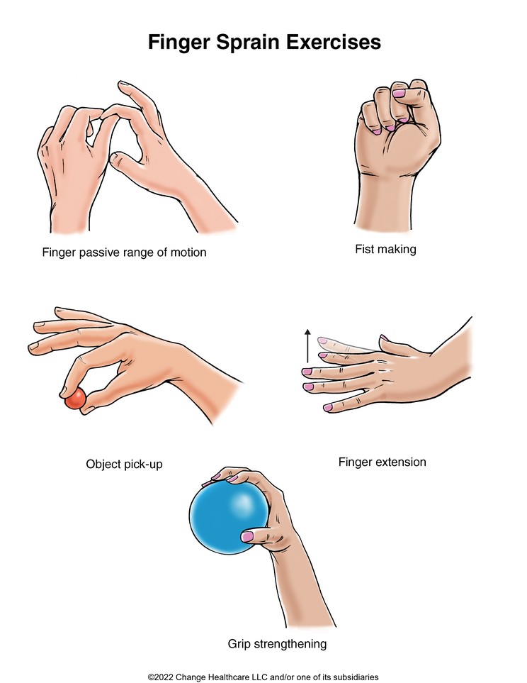 Finger Sprain Exercises: Illustration