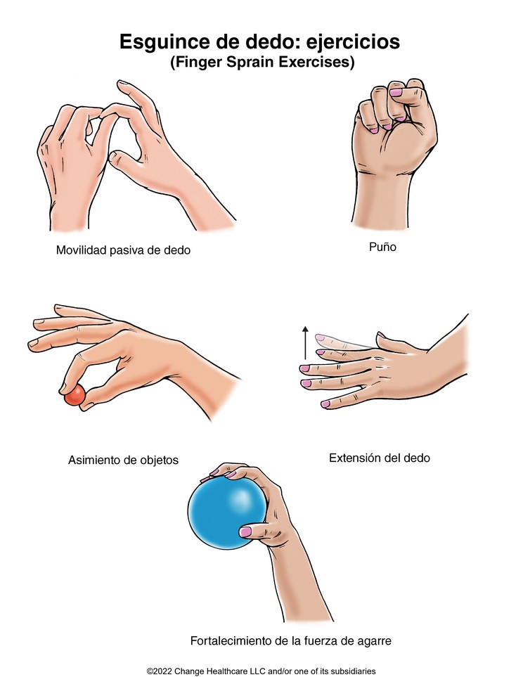 Finger Sprain Exercises: Illustration