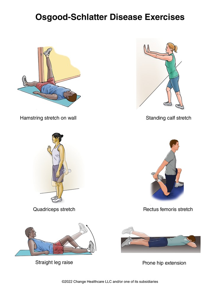 Osgood-Schlatter Disease Exercises: Illustration, page 1