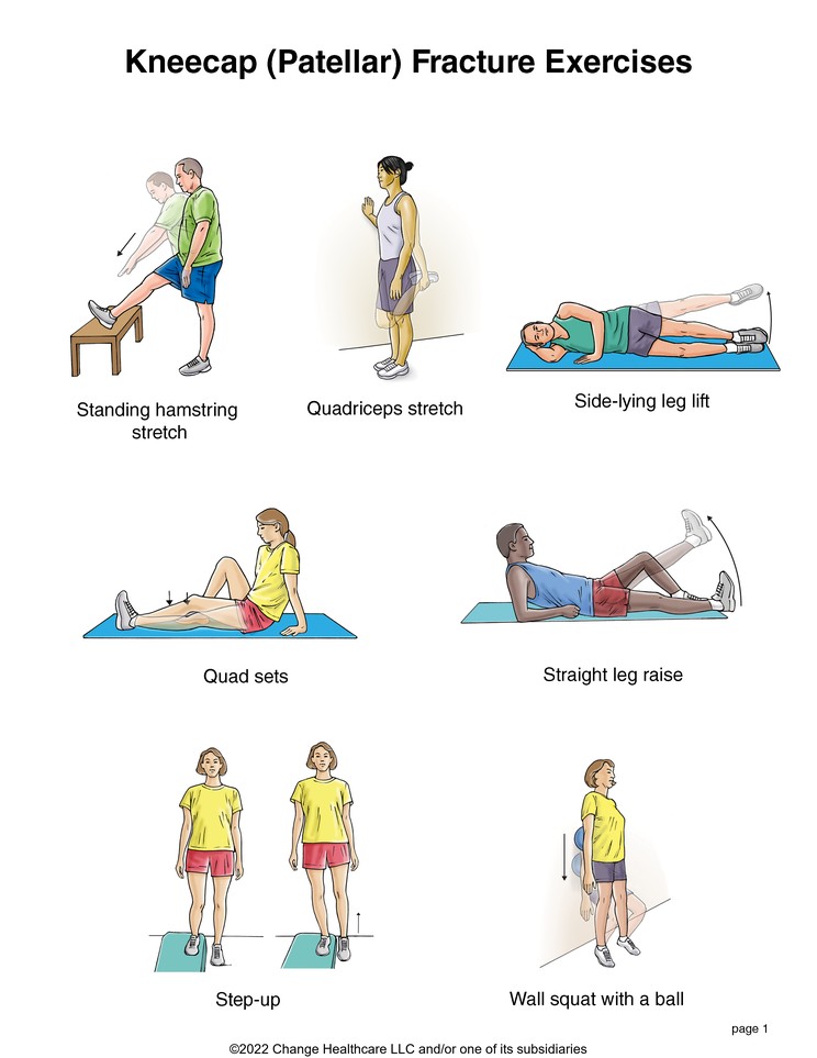 Kneecap (Patellar) Fracture Exercises: Illustration, page 1