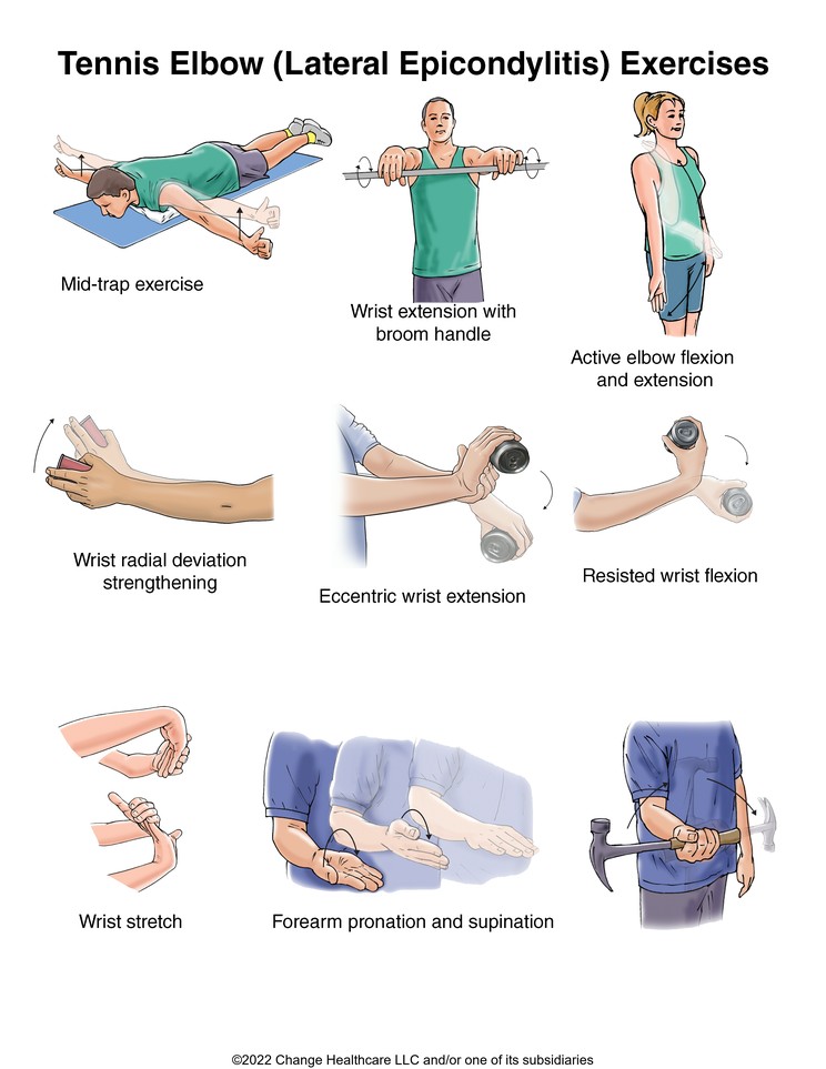 Tennis Elbow (Lateral Epicondylitis) Exercises: Illustration