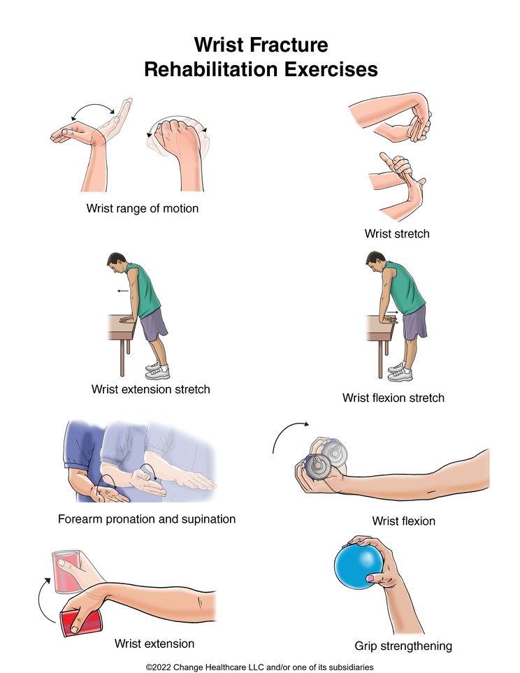 Wrist Fracture Exercises: Illustration