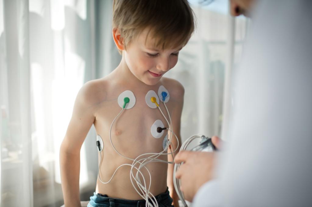 Photo of EKG